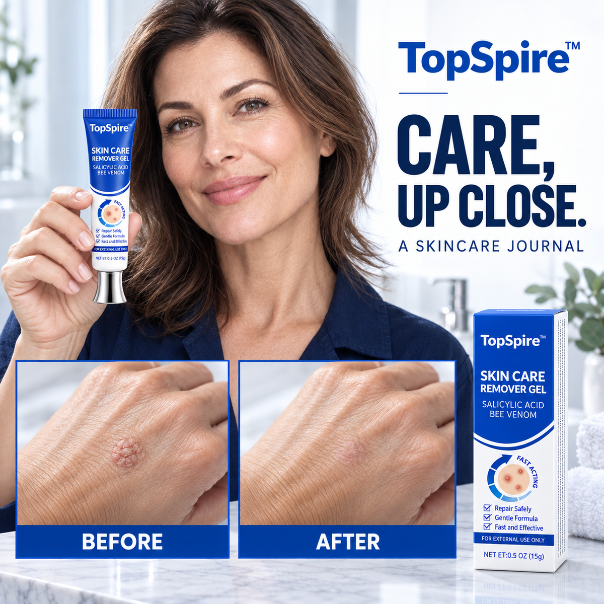 TopSpire™ Salicylic Acid Skin Repair Gel