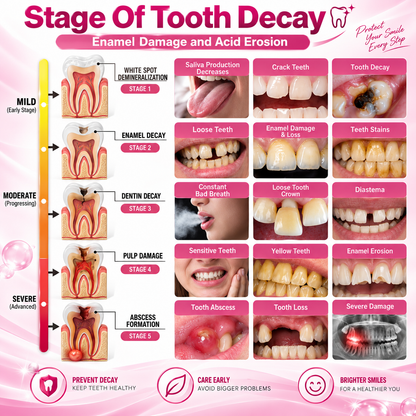 TopSpire™ DenPerm Cavity-Repair Natural Enamel Filling Gel